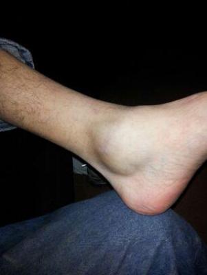 post-45228-0-22023500-1362388202_thumb.jpg